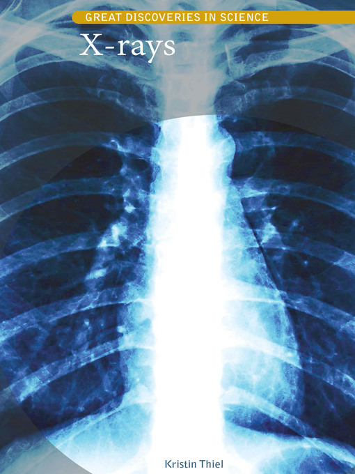 Title details for X-rays by Kristin Thiel - Available